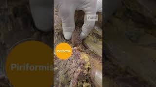 Piriformis Sciatic Nerve and Obturator Internus Anatomy [upl. by Monti166]