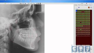Manuseando Ferramentas da Cefalometria [upl. by Olinad141]
