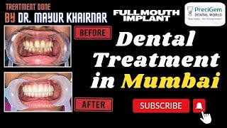 Dental Treatment In Mumbai  Dental Specialist  Best Dental Clinic in Mumbai  Dr Mayur Khairnar [upl. by Drapehs]