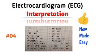 How to Read an ECG interpretation  04 Pwave [upl. by Ashling381]