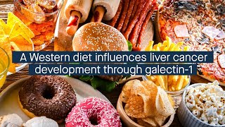 A Western diet affects galectin1 signaling promoting the development of liver cancer [upl. by Syd]