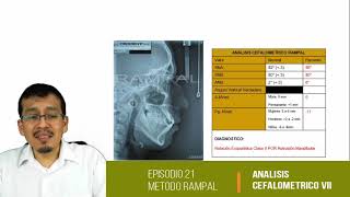 Cefalometría VIII Evaluación de Vertebras Cervicales [upl. by Yrrac]