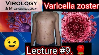 varicella zoster virus varicella zoster infection 🛑🛑🛑 clinicalVirology microbiology mbbs bds [upl. by Jago432]