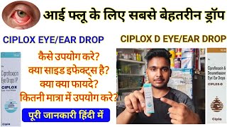 CIPLOX EYE DROPS  CIPLOX D EYE DROPS  CIPROFLOXACIN EYE DROPS IP  CIPLOX EYE DROP USES IN HINDI [upl. by Afaw]