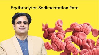 Erythrocytes Sedimentation Rate ESR [upl. by Ekard907]