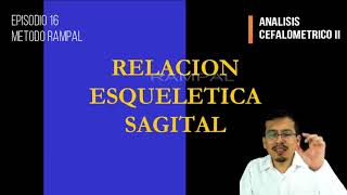 Cefalometría III Relación Esquelética Sagital [upl. by Vinna]