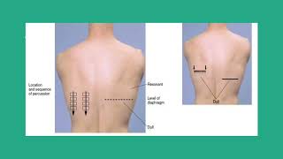 CARDIOPULMONARY ASSESSMENT CHEST EXPANSION MEASUREMENT amp DIAPHRAGMATIC EXCURSION [upl. by Dougall86]