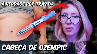 A VERDADE JAMAIS CONTADA sobre o FENÔMENO DA CABEÇA DE OZEMPIC do Tiktok INACREDITÁVEL [upl. by Artemus]