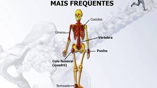 Doenças osteoarticulares mais frequentes na Atenção Primária de Saúde [upl. by Ienttirb]