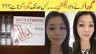 Glutathione Skin Whitening Injections Explained Before amp After Results Urdu HIndi [upl. by Corby331]