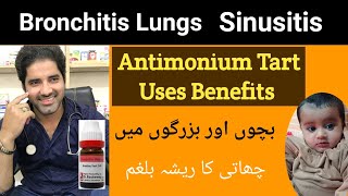 Antimonium tart homeopathic medicine uses antim tart 30 200 benefits  Dr Sherazi Homeopathic [upl. by Theresa]