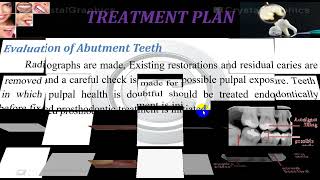 Diagnosis and treatment planing in fixed prosthdontics part two [upl. by Tnafni]