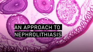 An approach to nephrolithiasis [upl. by Nivahb]