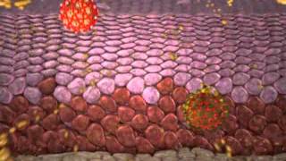 Cervical intraepithelial neoplasia [upl. by Follansbee17]