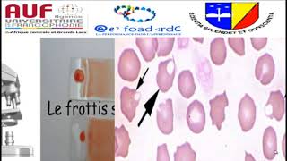 MORPHOLOGIE EN HEMATOLOGIE EPISODE 7 [upl. by Rekoob]