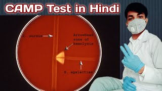 CAMP Test in hindi  CAMP test for streptococcus agalactiae  CAMP Test procedure  Microbiology [upl. by Millicent]