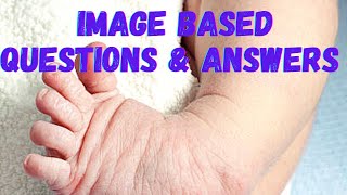 Image Based Questions  Child Health Nursing  Important Questions  Answers [upl. by Naenaj416]