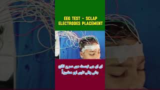 EEG test video and EEG leads with machine [upl. by Pump]