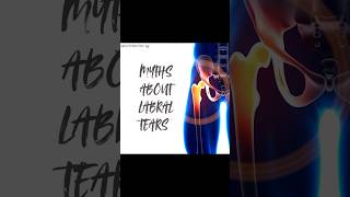 letstalkabout hip labral tears myths sports sportsmedicine sportsdoctor fyp [upl. by Petrie]