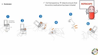 INHALERS TYPES amp HOW TO USE [upl. by Oidgime710]