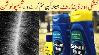 How to get rid of Dandruff Best Anti Dandruff Shampoo Selsun Blue Shampoo Review amp Price [upl. by Meece226]