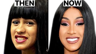 Cardi B NEW FACE  Plastic Surgery Analysis [upl. by Ariuqahs32]