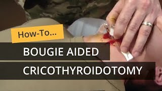 Bougie Aided Cricothyroidotomy [upl. by Akeemat]