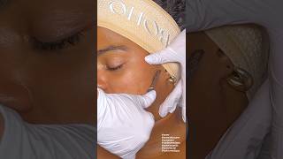 ASMR Dermaplaning Facial [upl. by Nerual13]