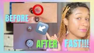 How to get rid of a bumpkeloid on belly piercing REAL Divyne [upl. by Freeborn]