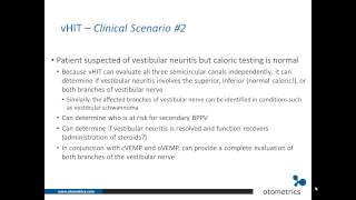 ICS Impulse vHIT Clinical applications [upl. by Eph]