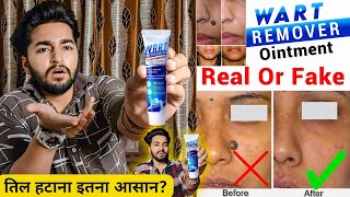 Wart Removal Cream Really Works  Wart Removal Cream Real Or Fake [upl. by Epp]