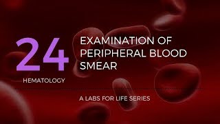 Part 2  Examination of Peripheral Blood Smear [upl. by Xuaegram]