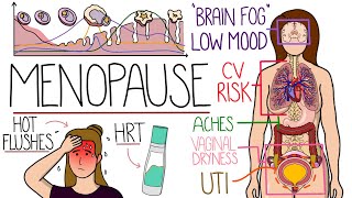 Menopause Explained Clearly Includes HRT amp Perimenopause [upl. by Enelegna]