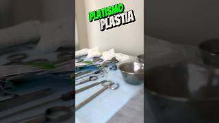 Platismoplastia Cirurgia da Papada platismoplastia papada bucomaxilofacial clinicaceconi [upl. by Marquis]