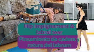 EP 0  Hip impingement and labral tear  Pinzamiento de cadera y rotura del labrum  TRAILER [upl. by Eitsyrhc368]