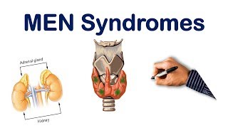 Multiple Endocrine Neoplasia MEN Mnemonic [upl. by Ardrey]