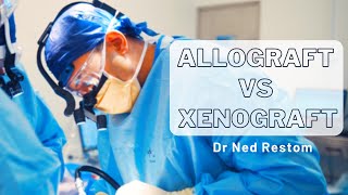 Interview with Dr Ned Restom  Allograft vs Xenograft [upl. by Aicele294]