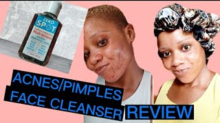 Acnes pimples face cleanser reviews 09044378368 [upl. by Heddy]