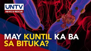 Pagkakaroon ng kuntil o polyps sa bituka posibleng mauwi sa colon cancer – expert [upl. by Theodosia]