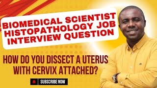 HOW DO YOU DISSECT A UTERUS WITH CERVIX ATTACHED [upl. by Werna536]