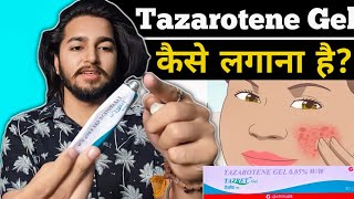 How to use Tazarotene Gel  How to Apply Tazarotene Gel  Tazret Forte 005 [upl. by Jorgenson]