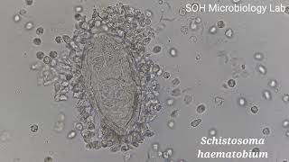 Schistosoma haematobium Ova in Urine [upl. by Anelleh]