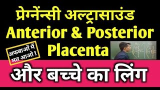 Baby Gender  Placenta Position ll Anterior or Posterior Placenta position ll Ultrasound Report [upl. by Cuhp50]