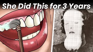 How a Forced Bad Habit Destroyed a Womans Jaw [upl. by Ahcsatan]