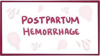 Postpartum hemorrhage  causes symptoms diagnosis treatment pathology [upl. by Einahpit898]