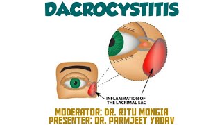 Dacryocystitis  Symptoms  Causes  Treatment [upl. by Anirok55]