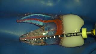 Dentsply Protaper NEXT Rotary File Easy Shaping Sequence [upl. by Randal]