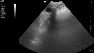 urinary bladder stone in a dog ultrasound urolithiasis [upl. by Riorsson457]