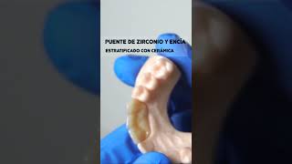 Puente de Zirconio estratificado con cerámica y cerámica de encíaimpresión dental 3d [upl. by Yknip]