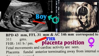 Pregnancy Ultrasound Report Kaise Dekhe  Pregnancy Ultrasound Report Boy Or Girl  Boy Ultrasound [upl. by Karsten]